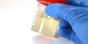 Urinalysis Online Training Module